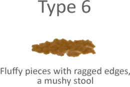 Stool Chart Type 6 Causes